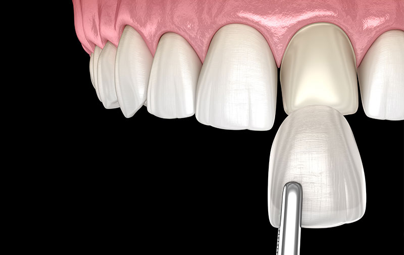 安心安全のための設備