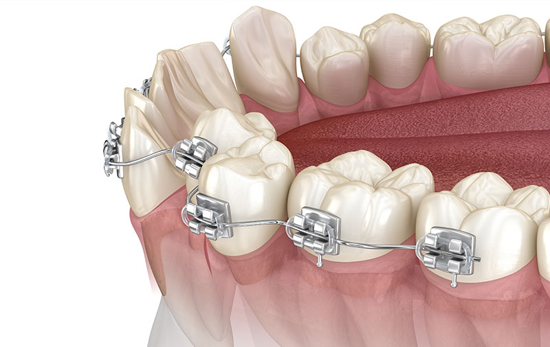 安心安全のための設備