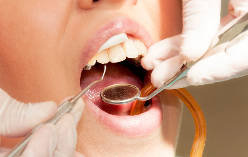 安心安全のための設備