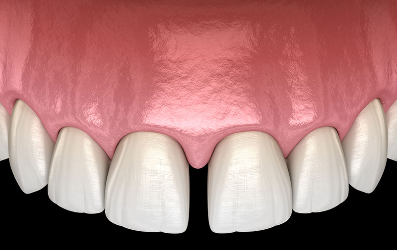 安心安全のための設備