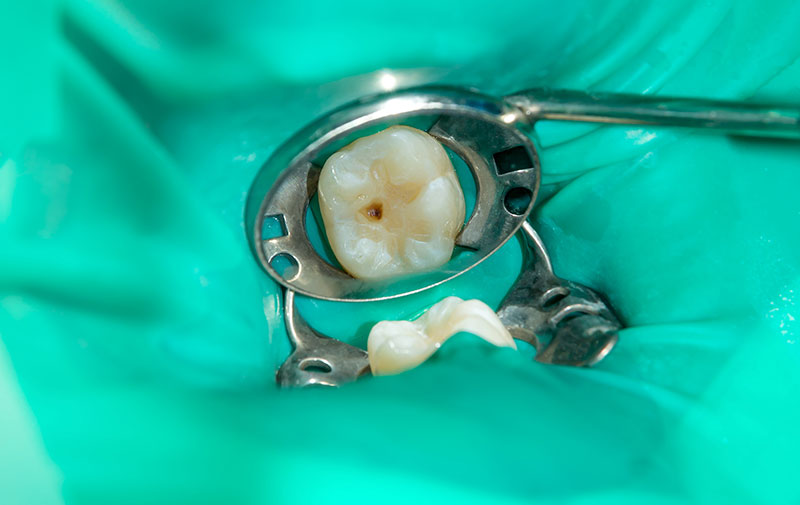 安心安全のための設備