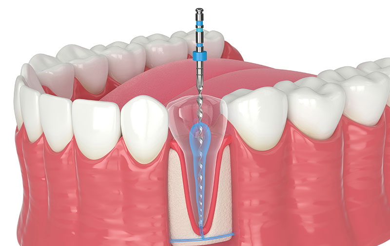 安心安全のための設備