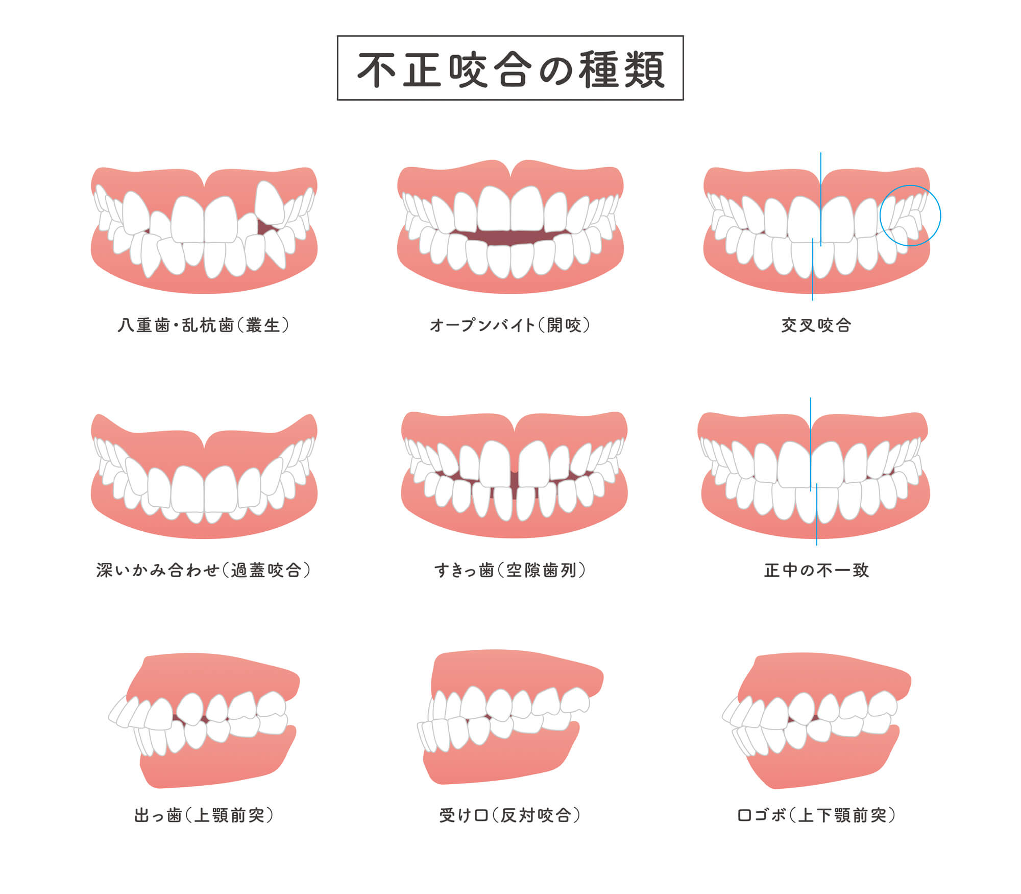 当院に来られる患者様はこういうお悩みが多いです