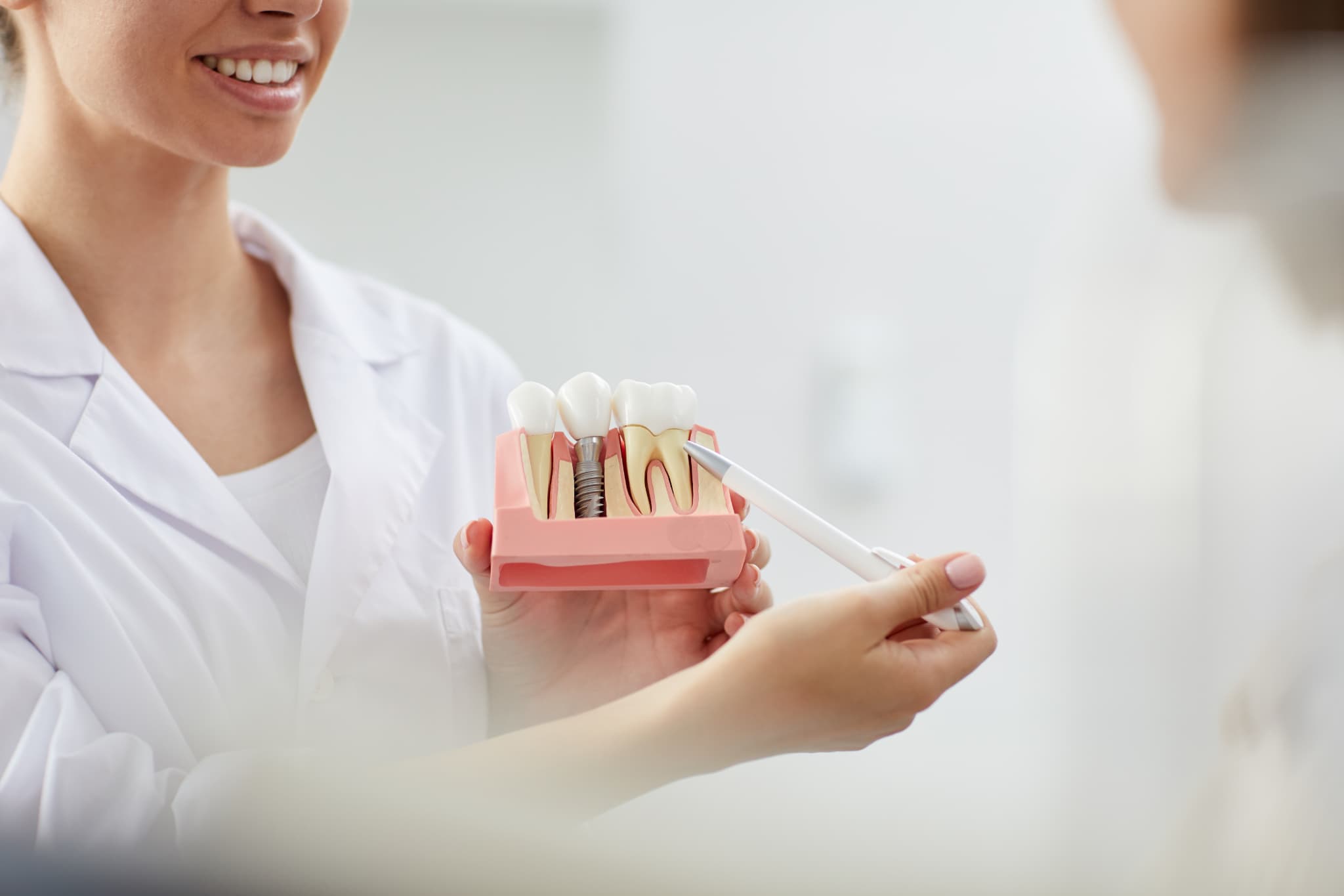 インプラントについて説明をする歯科医師