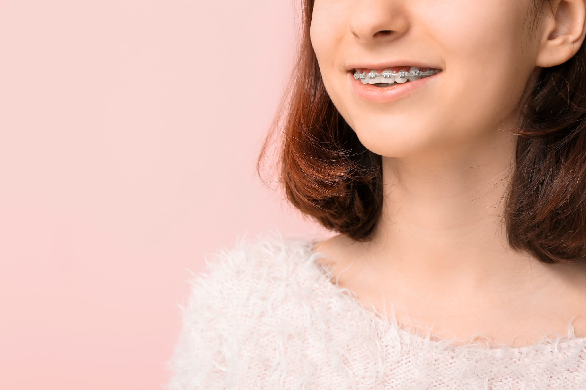 ワイヤー矯正中の女性の口元