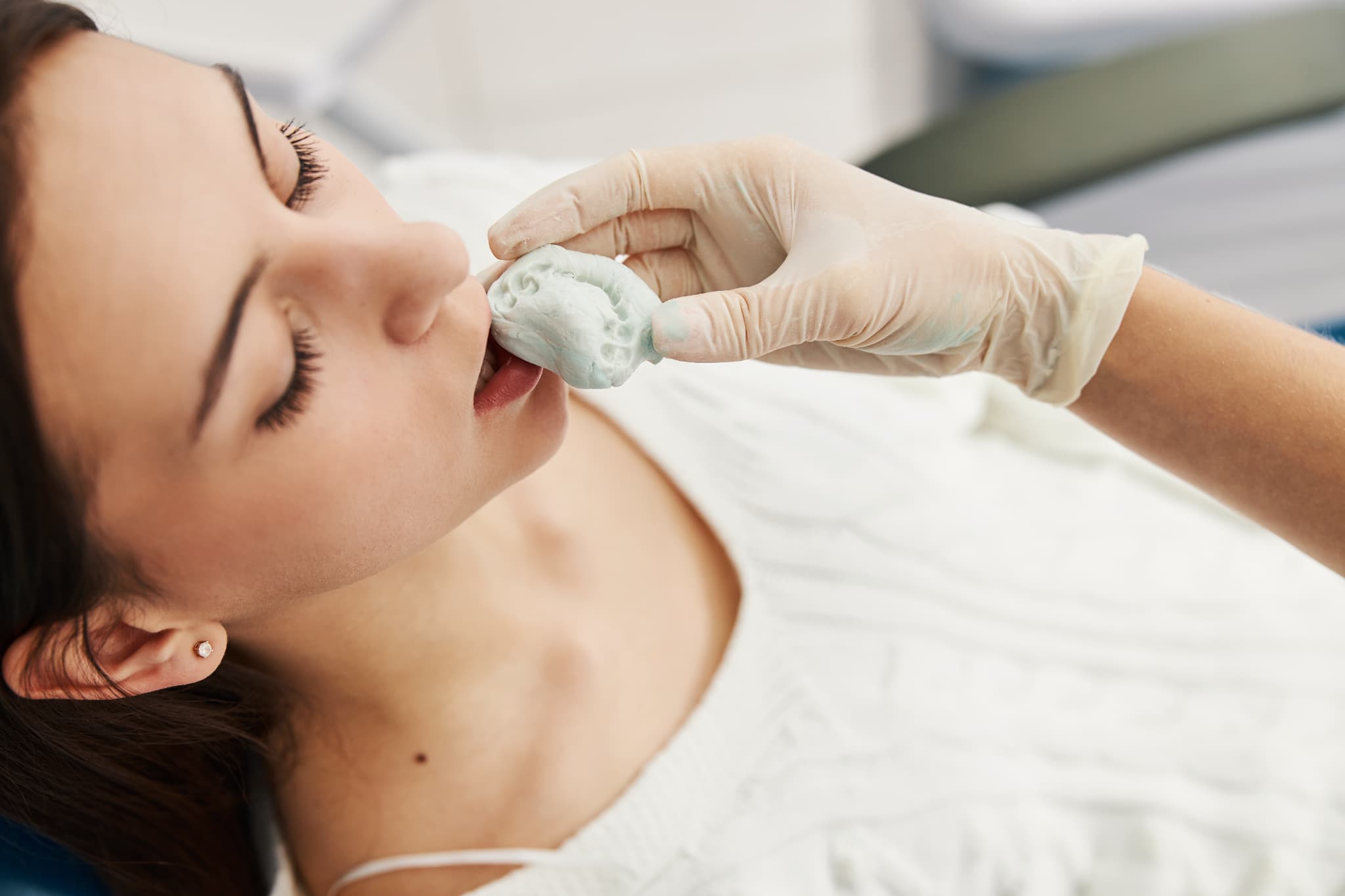 歯の型取りをする様子