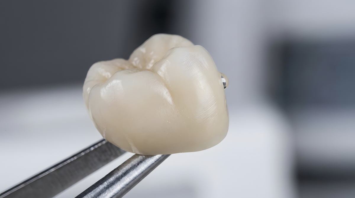 奥歯に使うセラミックの歯
